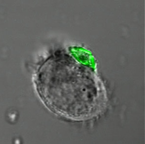Célula inmune con su carga de medicamentos, en verde. (Foto: MIT)