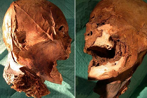 Dos vistas laterales de la reliquia. | BMJ
