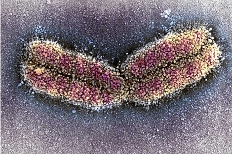 Un cromosoma humano. | Science Photo Library