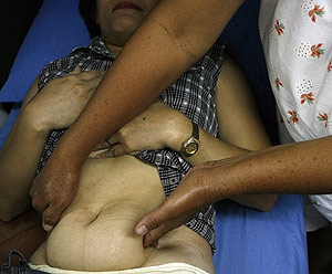 Minda, una matrona tradicional, demuestra la técnica de masaje que emplea para provocar abortos. (Foto: Cheryl Ravelo | Reuters)