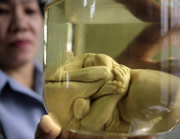 Una profesora muestra un feto en una clase de ciencias en un colegio de Manila. (Foto: Cheryl Ravelo | Reuters)