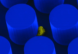 Una c&eacute;lula cancerosa se adhiere a uno de los orificios del chip (Foto: H. Massachusetts)