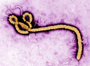 Imagen coloreada de una partícula del virus del Ébola (Foto: CDC | Cynthia Goldsmith)