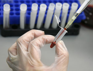 Un t�cnico de laboratorio examina una muestra de sangre para detectar el VIH (Reuters)