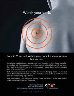 Campaña sobre el melanoma 'Observa tu espalda'. (Foto: 'Archives of Dermatology')