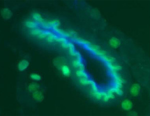 Imagen de cómo interactúan las células tumorales, en verde, y el receptor CCL19 en azul (Foto: Nature | NYU School of Medicine)