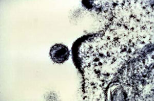 Virus del VIH junto a una célula T. (Foto: Tom Folks | NIAID)
