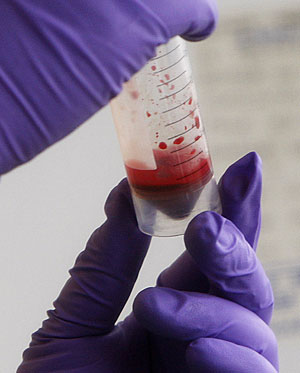 Muestra de sangre. (Foto: Stephen Hird | Reuters)
