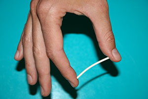 anticonceptivo