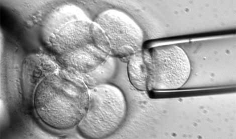 Un momento de la toma de la célula. | Advanced Cell