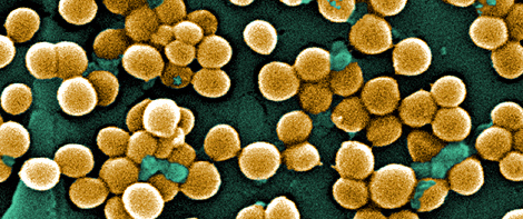 Imagen del patógeno en el laboratorio. | CDC