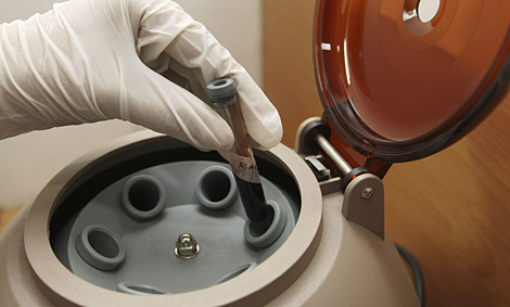 Un técnico introduce un tubo de sangre en una centrifugadora. | Rolex dela Pena