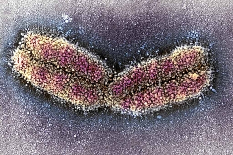 Imagen microscópica de un cromosoma. | Science Photo Library