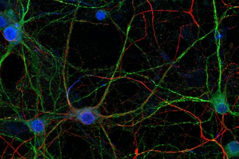 Neuronas del cerebro con el núcleo en azul, sus dendritas en verde y los axones en rojo.
