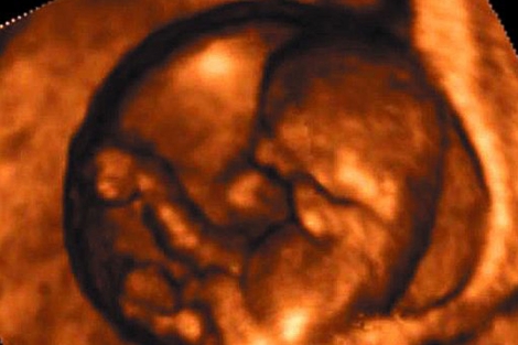 Vista de un feto de 10 semanas por la técnica de ecografía 4 D. | El Mundo