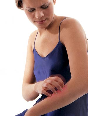 La psoriasis